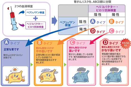 胃がんABC検査